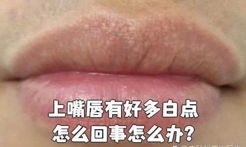 大姨妈期间可以喝红豆薏米粥吗-大姨妈期间能不能喝红豆薏仁网-分享姨妈期可以喝红豆薏米吗，姨妈期可以喝红豆薏米吗知识库